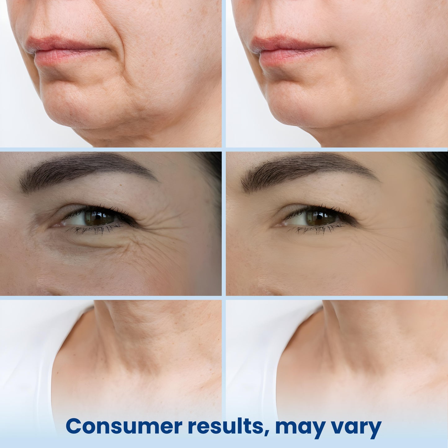 GLASS SKIN 3% Hyaluronic Acid Ultra Hydrating Serum by Turmiskin