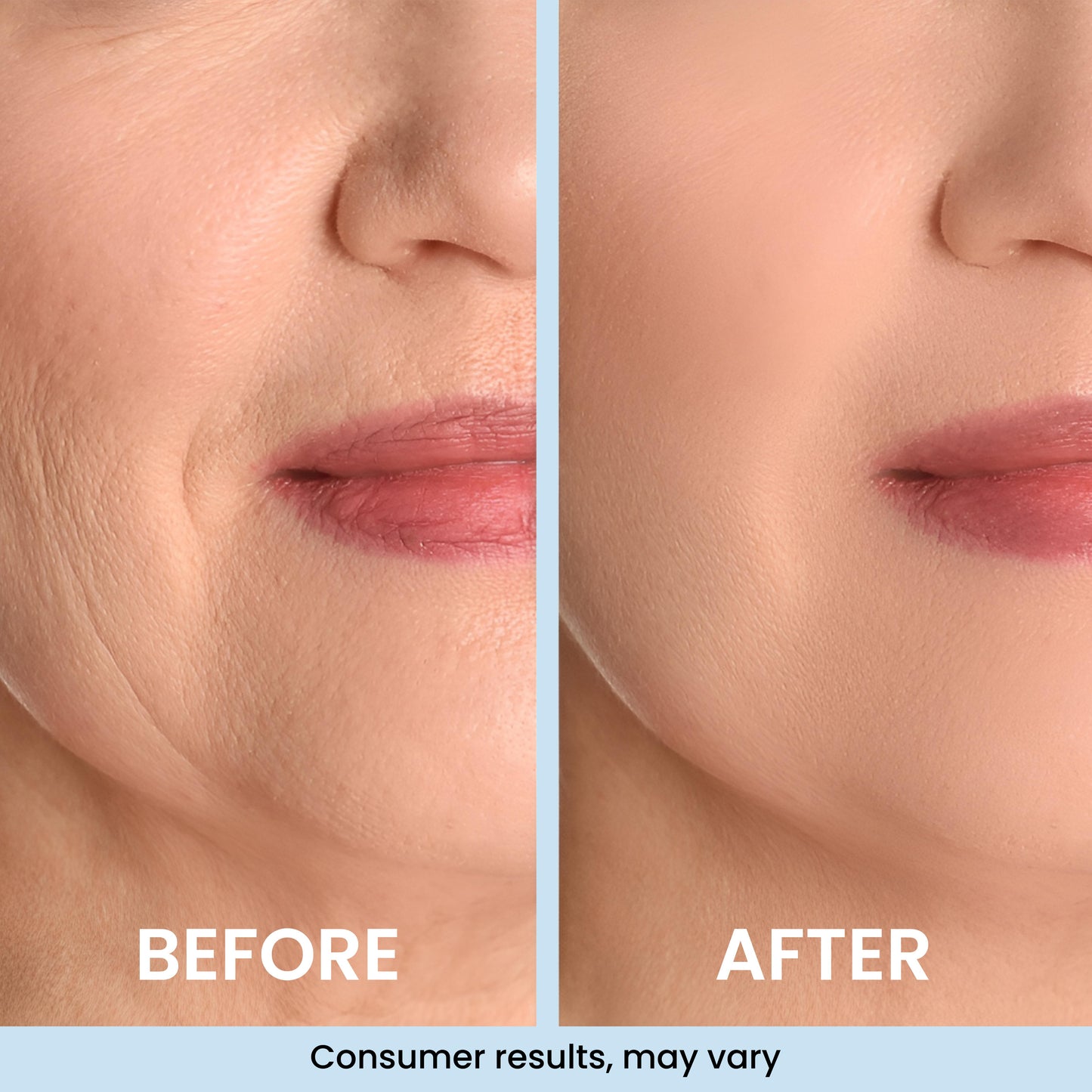 GLASS SKIN 3% Hyaluronic Acid Ultra Hydrating Serum by Turmiskin
