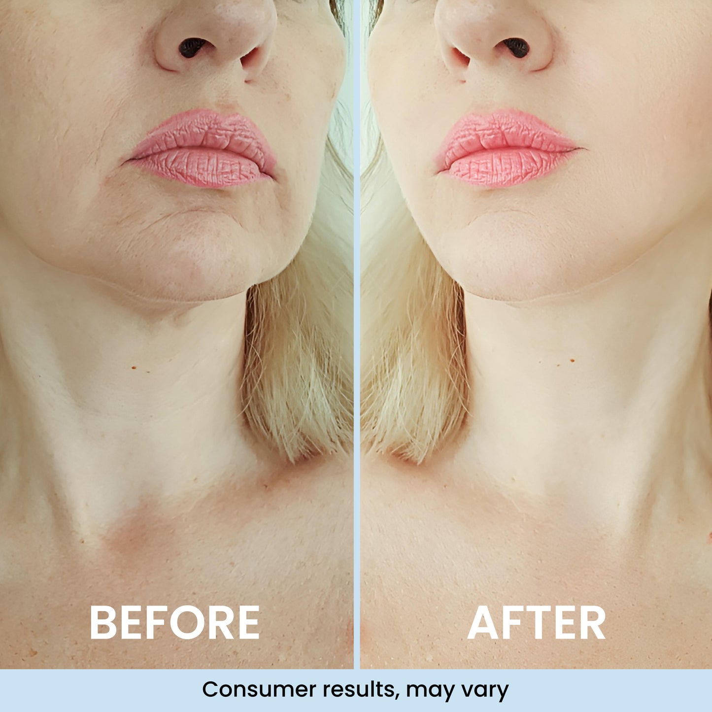 GLASS SKIN 3% Hyaluronic Acid Ultra Hydrating Serum by Turmiskin