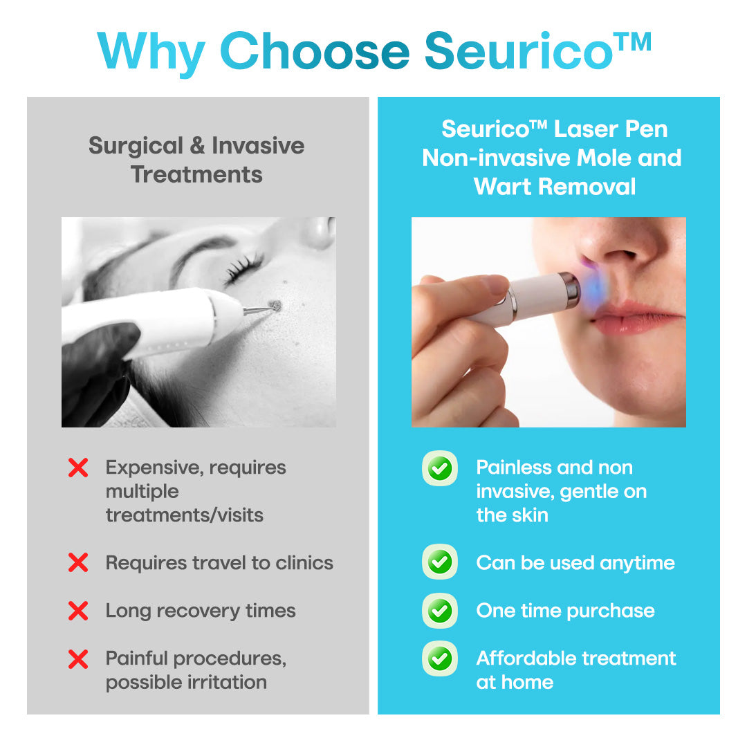 Seurico™ Painless Laser Mole & Wart Remover Pen – Fast At-Home Treatment