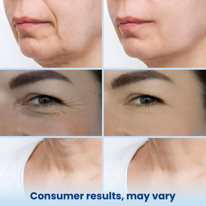 GLASS SKIN 3% Hyaluronic Acid Ultra Hydrating Serum by Turmiskin