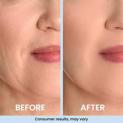 GLASS SKIN 3% Hyaluronic Acid Ultra Hydrating Serum by Turmiskin