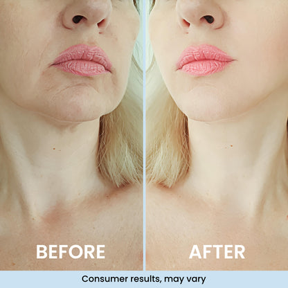 GLASS SKIN 3% Hyaluronic Acid Ultra Hydrating Serum by Turmiskin