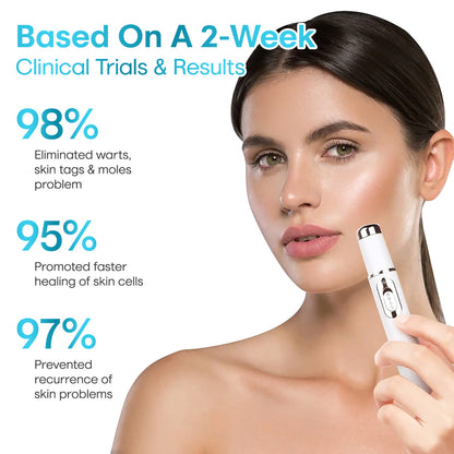 Seurico™ Painless Laser Mole & Wart Remover Pen – Fast At-Home Treatment