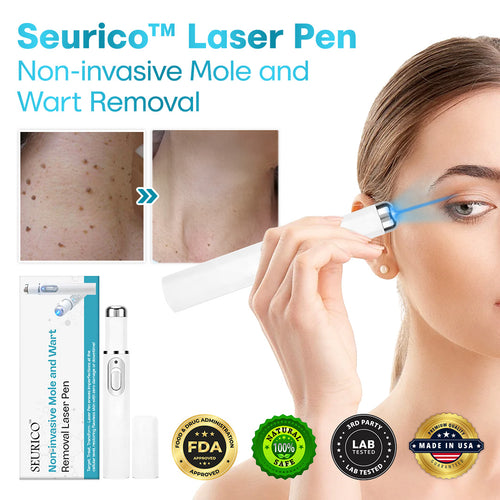 Seurico™ Painless Laser Mole & Wart Remover Pen – Fast At-Home Treatment