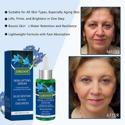Zakdavi™ SKIN-LIFTING Serum: The Ultimate Anti-Aging Solution for Firmer, Brighter, and Youthful Skin